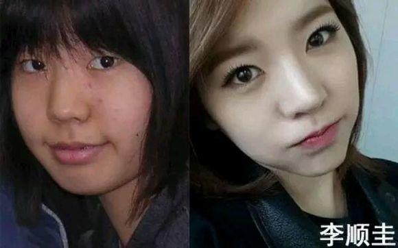 韩国公认10大整容美女名单,盘点韩国几位承认整容的女星