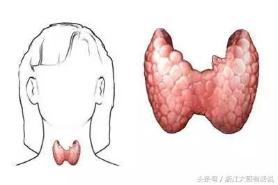 发现甲状腺结节如何处理,发现甲状腺结节怎么处理