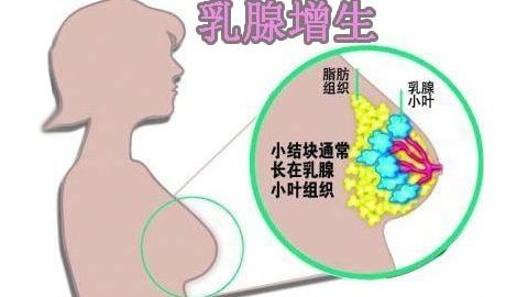 乳腺囊性增生吃中药调理有用吗,乳腺增生小叶增生怎么调理才能好