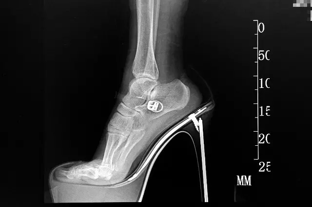 有助于儿童成长的鞋,如何选择适合孩子的儿童鞋