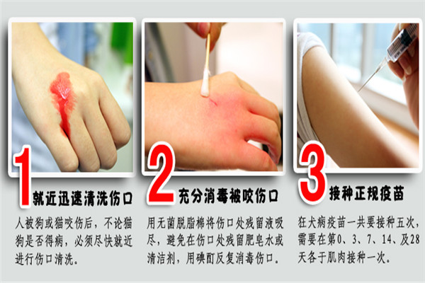 被野猫抓出血了需要打狂犬疫苗吗,被金丝熊咬出血了要打狂犬疫苗吗