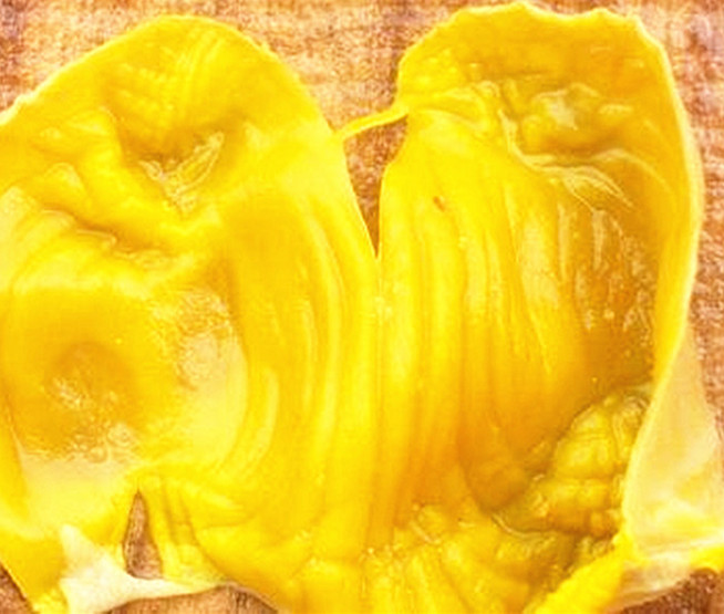 有些人为什么慎用鸡内金,鸡内金到底有多可怕