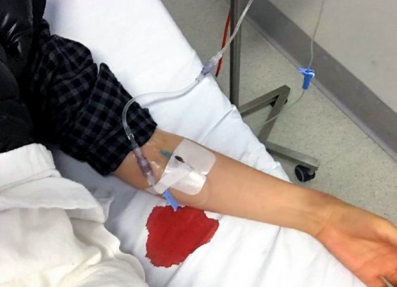 一针见血的方法,一针见血的方法与技巧