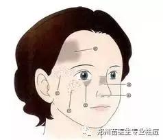 真皮斑是斑中之癌说法对吗,真皮斑为什么叫斑癌