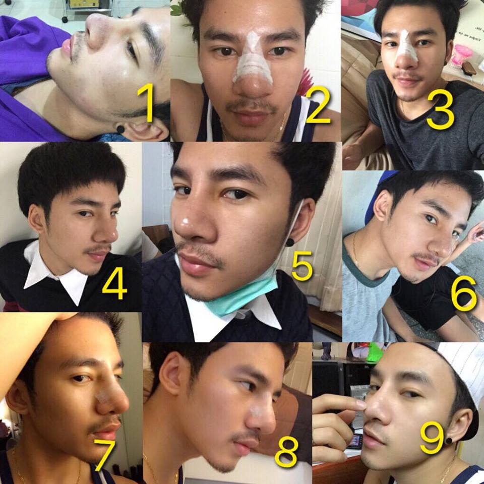 论高鼻梁的重要性,男人高鼻梁重要性