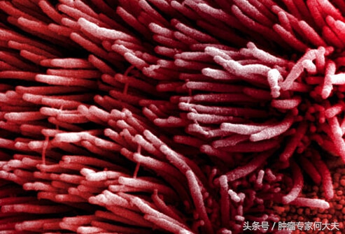 被查出肺癌一期,80岁老人肺癌晚期吃中药有效果吗