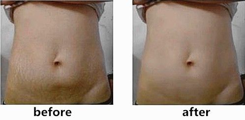 深扒那些爆火的网红减肥法,深扒8种抗衰老成分