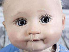 宝宝不到一岁有点流清鼻涕打喷嚏,不到一岁的宝宝流黄色的鼻涕
