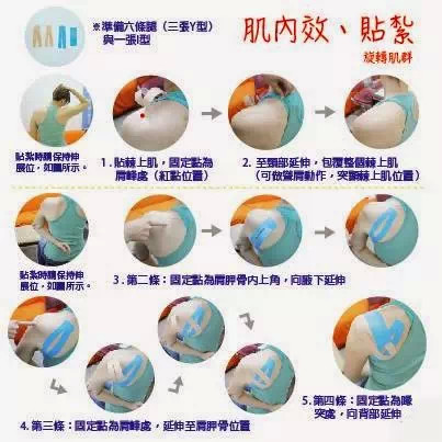 排球运动员如何保护肩关节,排球运动容易出现肩袖肌群损伤