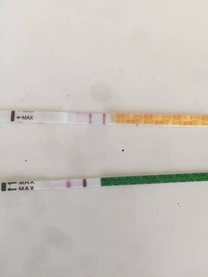 多囊卵巢一旦怀孕就自愈了吗,多囊卵巢一直不治疗会怎样