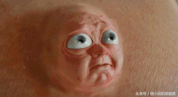 嘴周边老起痘痘闭口怎么办,闭口痘痘如何正确祛痘