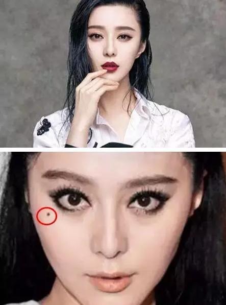 赵丽颖脸部痣,赵丽颖脸上美人痣