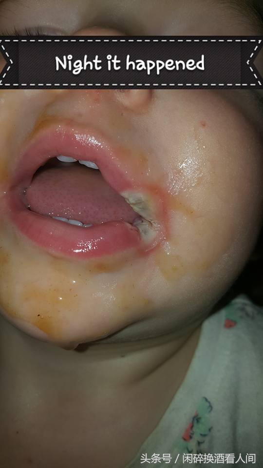 儿童接触手机充电器事故,儿童充电器事故视频