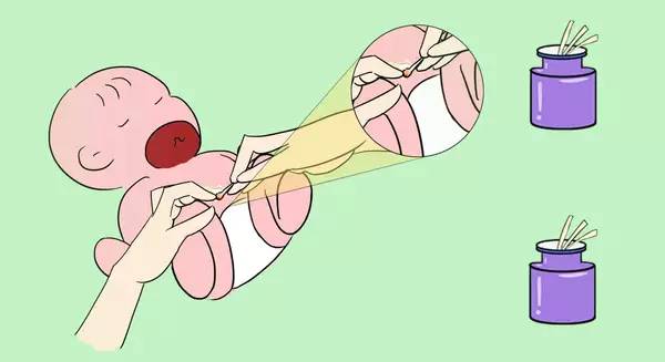 宝宝脐炎的症状图,脐茸和脐炎需要住医院吗