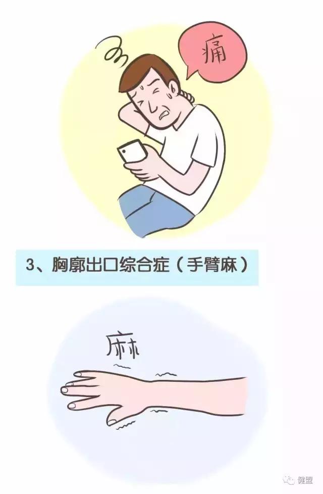 成年人驼背耸肩,一招拯救圆肩驼背