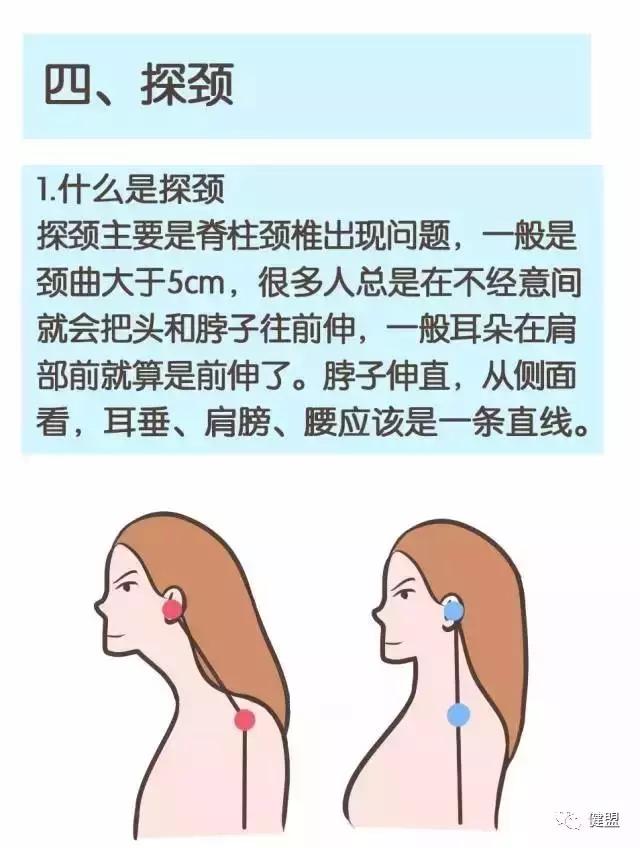 成年人驼背耸肩,一招拯救圆肩驼背