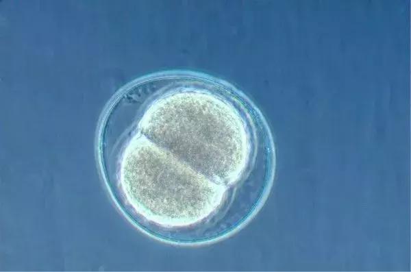 多个卵泡会导致不孕吗,多卵泡医生不建议备孕