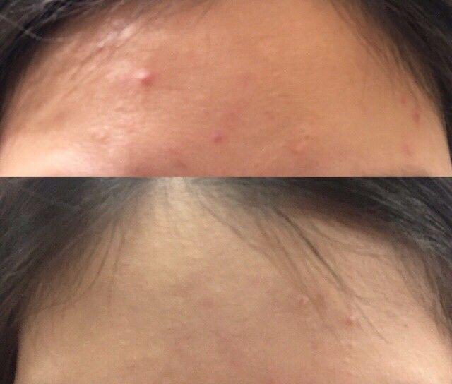 belulu美容仪,belulu便携美容仪