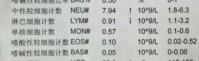 10秒看懂血常规报告单,三分钟教你看血常规