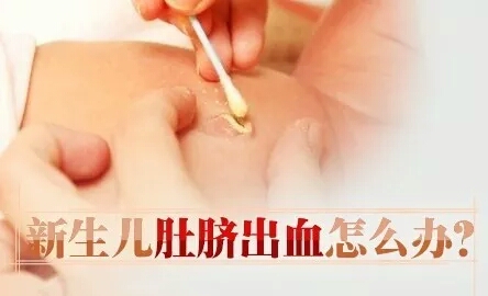 婴儿脐部出血怎么处理,新生婴儿肚脐出血应该怎么处理