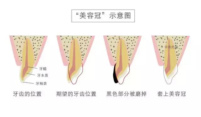 美容冠美白,一周快速脸部美白小妙招