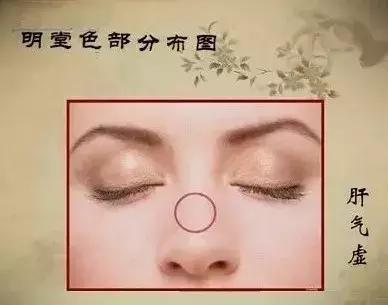 中医望诊鼻子发青,受凉鼻根发青是什么原因