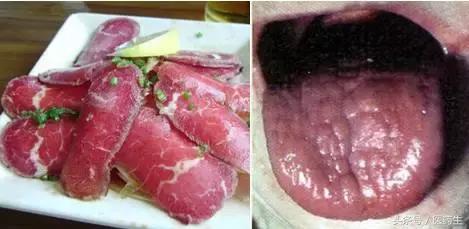 舌尖上的中医药论文,舌尖上的医疗