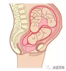 三胞胎的子宫变化,他们是三胞胎姐妹