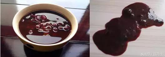 舌尖上的中医药论文,舌尖上的医疗