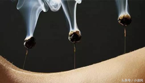 抑郁症艾灸禁忌与注意事项,手术后艾灸禁忌与注意事项