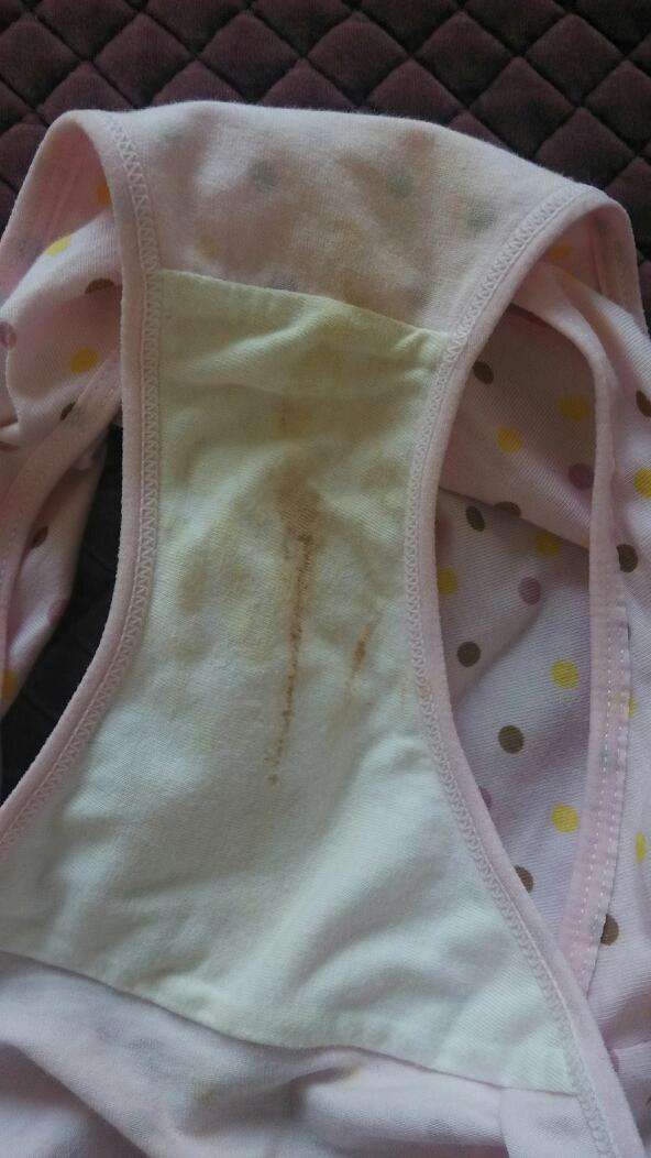 3岁女儿*裤内**有带血分泌物，医生检查后宝妈惭愧不已