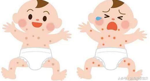 冬天儿童湿疹的最好解决方法,宝宝冬天湿疹高发怎么办