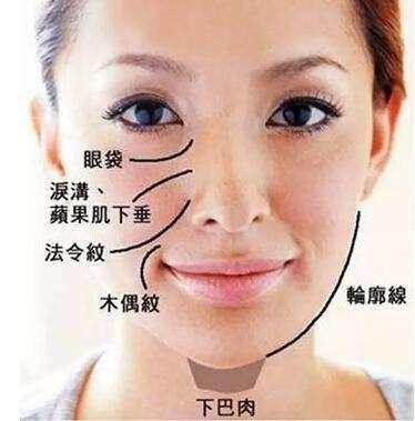 杨紫同款法令纹怎样去除,杨紫的法令纹怎么去掉的