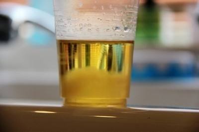 孕妇尿的尿发黄对胎儿有影响吗,孕早期小便发黄对胎儿有影响吗