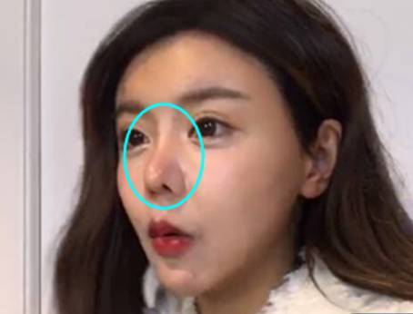 韩安冉第七次整鼻子效果,韩安冉鼻子是不是有问题