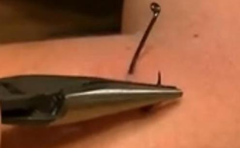 钓鱼怎么防止被钩到手,怎么钓鱼才不会被钩到呢