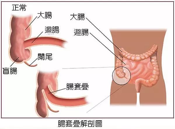 一岁多孩子半夜哭闹感觉腹痛,小孩肚子痛整夜哭闹