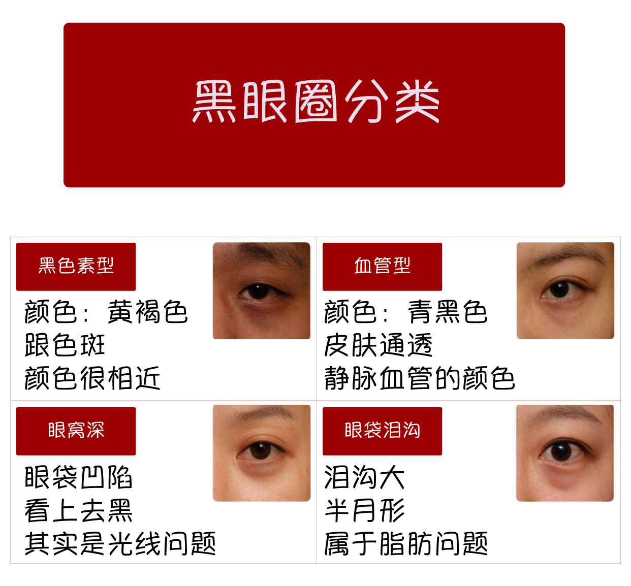 女大学生泪沟黑眼圈用什么眼霜,眼霜能去脂肪粒吗