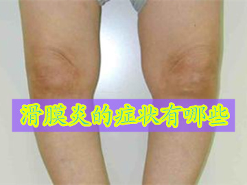 手指关节滑膜炎的症状图片大全,滑膜炎的五大症状及治疗