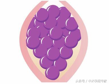 孕早期出血的孩子会有影响吗,孕早期出血孩子没了还会出血吗