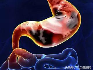 急性胃炎更难受3个小方法来急救,急性胃炎引起的心慌难受怎么办