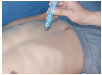 满满干货｜小小艾灸能量大，赶走酒瘾全靠它！