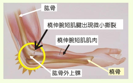 武汉女会计,女会计敲键盘