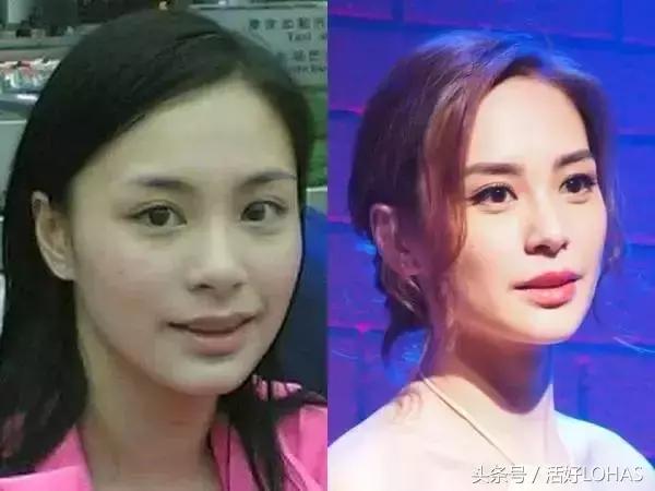 拯救发际线的生发神器,拯救发际线神器