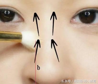 南阳时光整形除皱术,南阳时光假体隆鼻