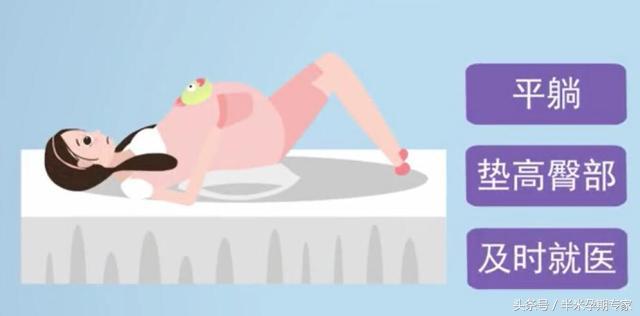 临产破水怎么躺,临产怎么看破水