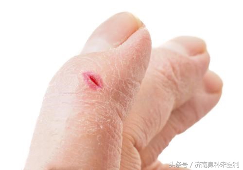 大病先兆自查表全文,大病先兆自查表格