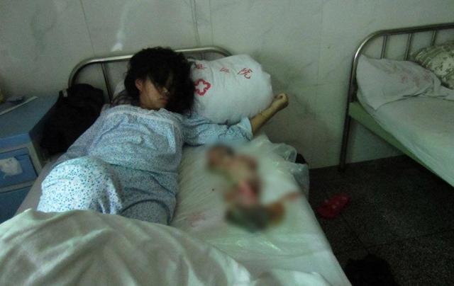 胎儿畸形8周引产后多久能再受孕,高龄畸形胎儿引产后多久可以再孕