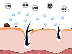 一招对付黑头,黑头清除大作战