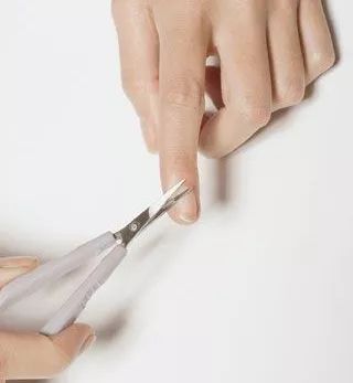 宝宝手上长倒刺脱皮缺什么,宝宝手起疹子皲裂